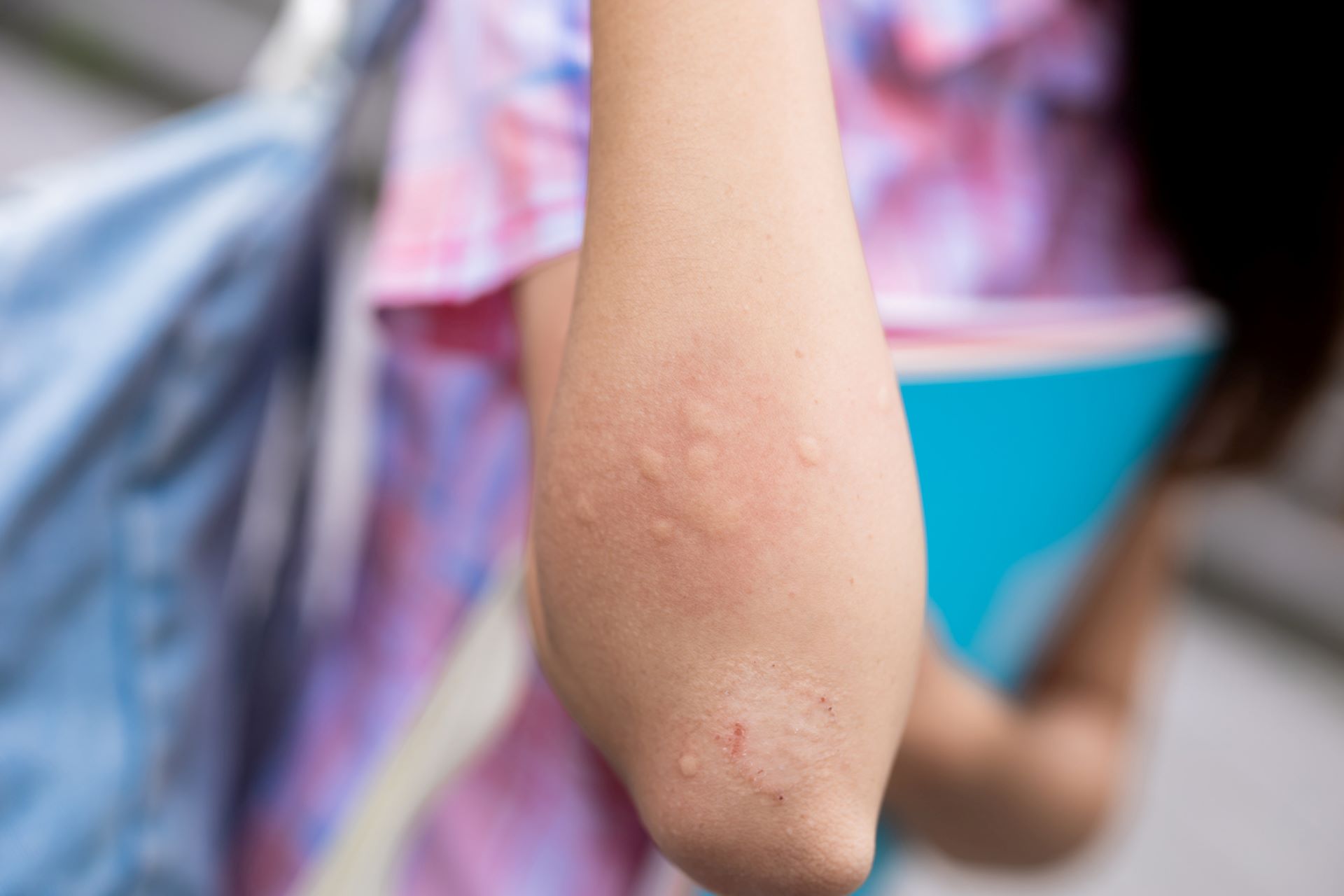 Gardener discovers 'genius' insect repellent hack that seems almost too good to be true: 'Bugs are so bad this year'