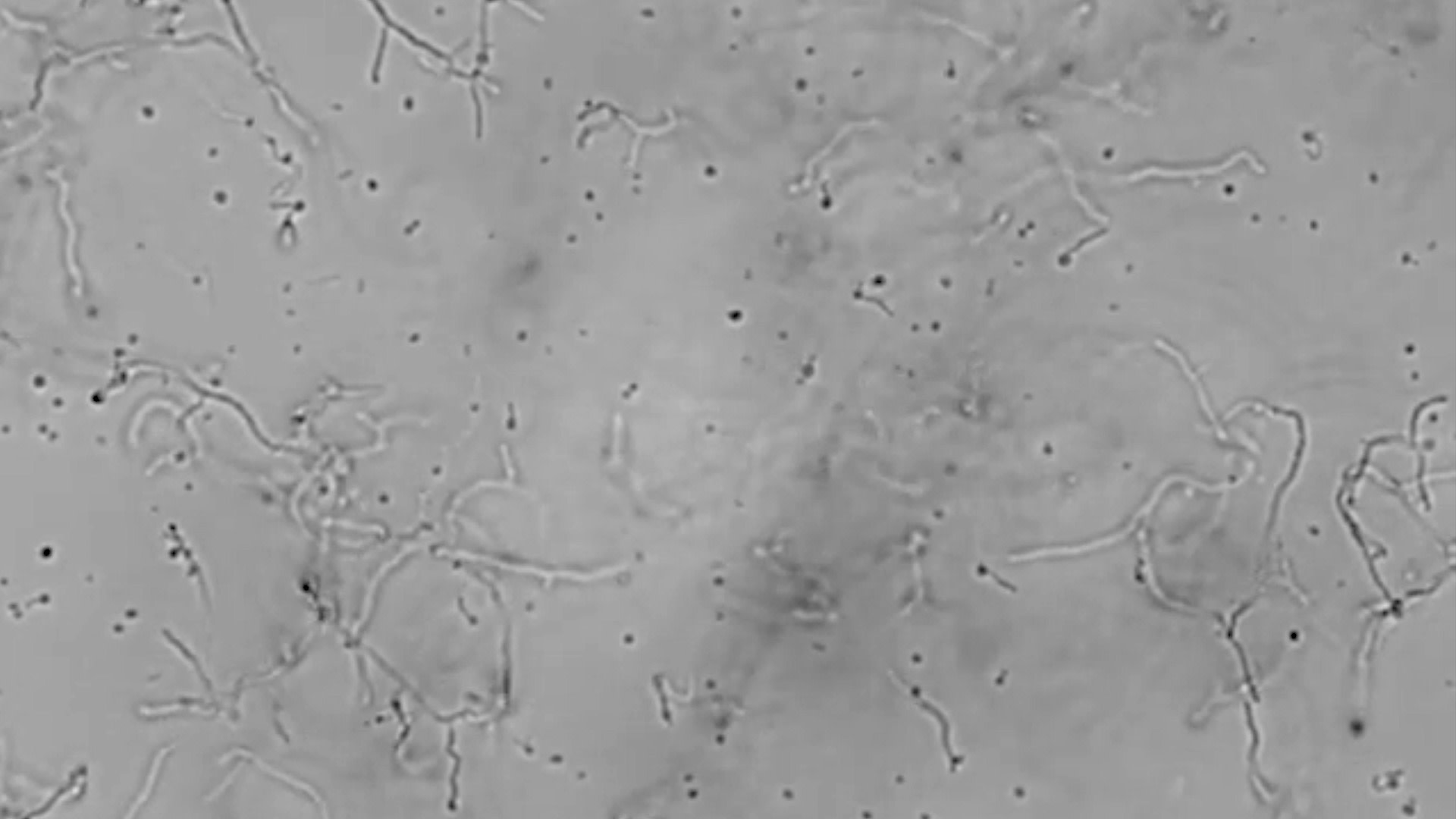 Naukowcy dokonują przełomowego odkrycia po podaniu bakteriom plastiku – oto, co mogą oznaczać wyniki